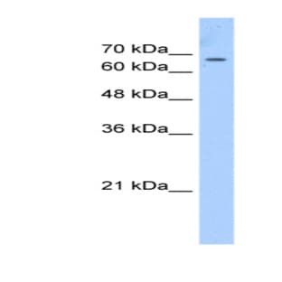 anti-Chromodomain Protein, Y-Linked, 1 (CDY1) (C-Term) antibody avatar