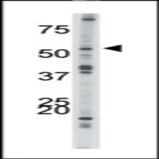 anti-Activin A Receptor, Type IB (ACVR1B) (N-Term) antibody avatar