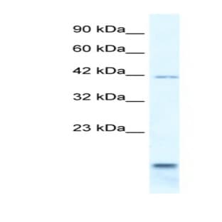 anti-Purinergic Receptor P2X, Ligand-Gated Ion Channel, 6 (P2RX6) (N-Term) antibody
