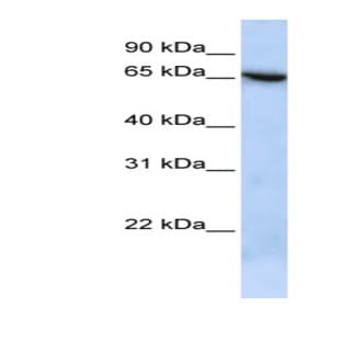 anti-Chromosome 19 Open Reading Frame 6 (C19orf6) (N-Term) antibody avatar