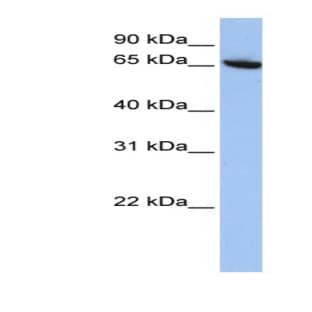 anti-Core-binding Factor, Runt Domain, alpha Subunit 2, Translocated To, 2 (CBFA2T2) (N-Term) antibody avatar