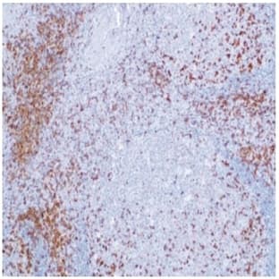 anti-CD2 Molecule (CD2) antibody avatar