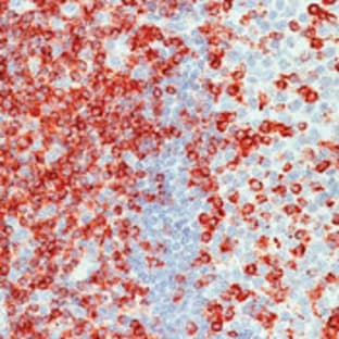 anti-CD2 Molecule (CD2) antibody avatar