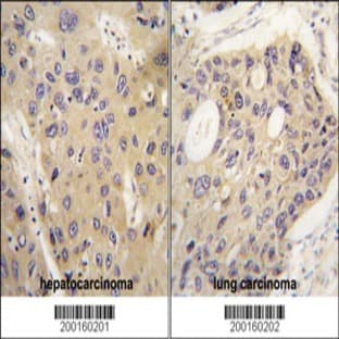 anti-Autophagy Related 12 (ATG12) antibody avatar