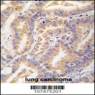 anti-Autophagy Related 12 (ATG12) (N-Term), (AA 1-30) antibody avatar