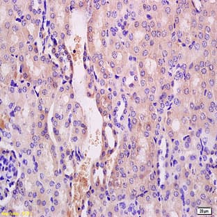 anti-Autophagy Related 12 (ATG12) antibody avatar