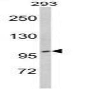 anti-CTD (Carboxy-terminal Domain, RNA Polymerase II, Polypeptide A) Phosphatase, Subunit 1 (CTDP1) (N-Term) antibody avatar