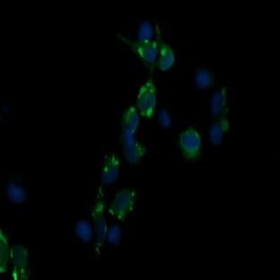 anti-CD3e Molecule, epsilon (CD3-TCR Complex) (CD3E) antibody avatar