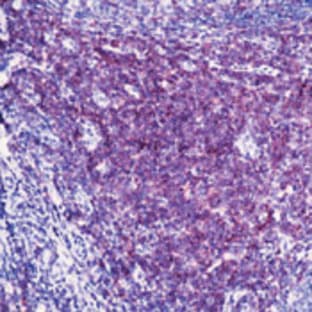 anti-CD3e Molecule, epsilon (CD3-TCR Complex) (CD3E) antibody avatar