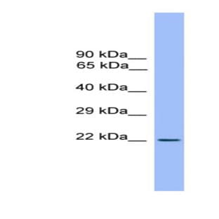 anti-CD3e Molecule, epsilon (CD3-TCR Complex) (CD3E) (Middle Region) antibody avatar
