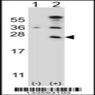 anti-CD3e Molecule, epsilon (CD3-TCR Complex) (CD3E) (C-Term), (AA 154-182) antibody avatar