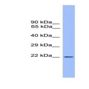 anti-CD3e Molecule, epsilon (CD3-TCR Complex) (CD3E) antibody avatar