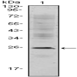 anti-CD3e Molecule, epsilon (CD3-TCR Complex) (CD3E) antibody avatar