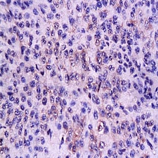 anti-CD3e Molecule, epsilon (CD3-TCR Complex) (CD3E) (C-Term) antibody avatar