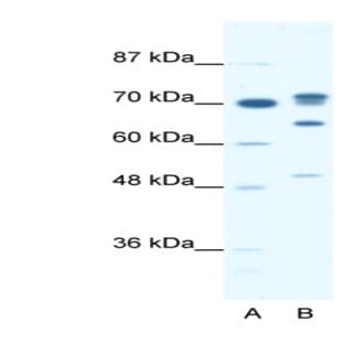 anti-DEAD (Asp-Glu-Ala-Asp) Box Polypeptide 21 (DDX21) (N-Term) antibody avatar