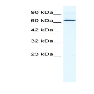 anti-DEAD (Asp-Glu-Ala-Asp) Box Polypeptide 21 (DDX21) (C-Term) antibody avatar