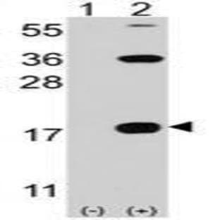 anti-CD247 Molecule (CD247) (C-Term) antibody avatar