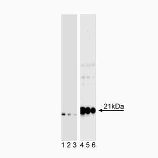 anti-CD247 Molecule (CD247) (pTyr142) antibody avatar