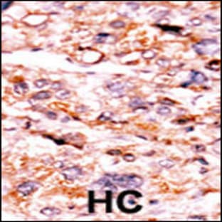 anti-Activin A Receptor, Type IIA (ACVR2A) (N-Term), (AA 2-29) antibody avatar