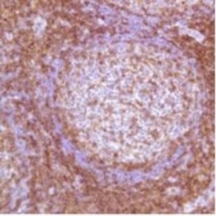 anti-CD4 Molecule (CD4) antibody avatar