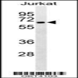 anti-CD4 Molecule (CD4) antibody avatar