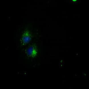 anti-CD4 Molecule (CD4) antibody avatar