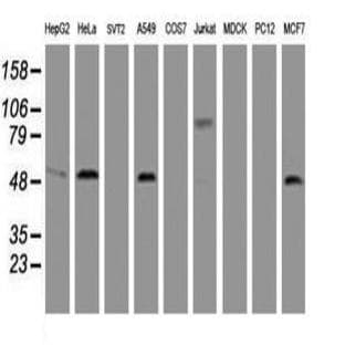 anti-CD4 Molecule (CD4) antibody avatar