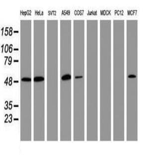anti-CD4 Molecule (CD4) antibody avatar