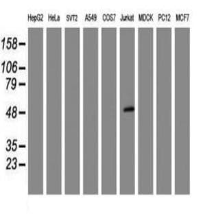 anti-CD4 Molecule (CD4) antibody avatar