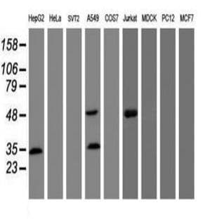 anti-CD4 Molecule (CD4) antibody avatar