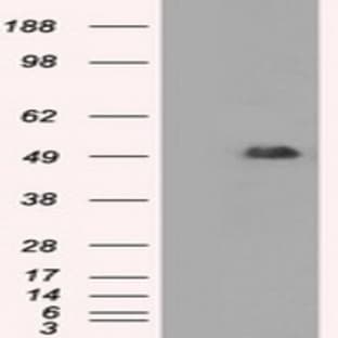anti-CD4 Molecule (CD4) antibody avatar