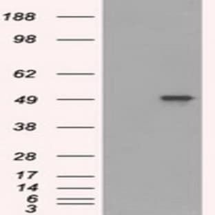 anti-CD4 Molecule (CD4) antibody avatar