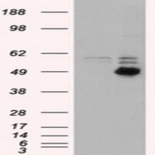 anti-CD4 Molecule (CD4) antibody avatar