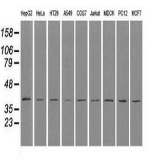 anti-CD4 Molecule (CD4) antibody avatar