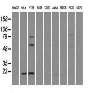 anti-CD4 Molecule (CD4) antibody avatar