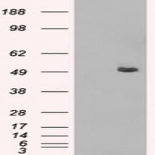 anti-CD4 Molecule (CD4) antibody avatar