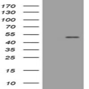 anti-CD4 Molecule (CD4) antibody avatar