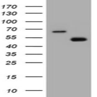 anti-CD4 Molecule (CD4) antibody avatar