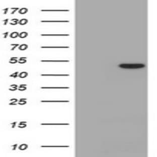 anti-CD4 Molecule (CD4) antibody avatar
