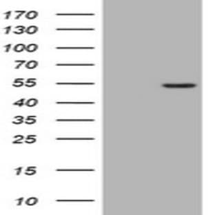 anti-CD4 Molecule (CD4) antibody avatar