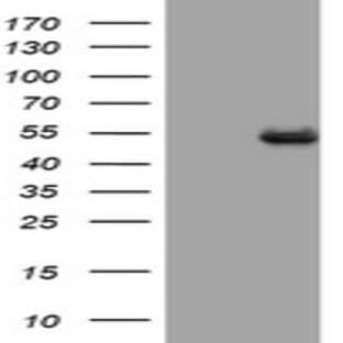 anti-CD4 Molecule (CD4) antibody avatar