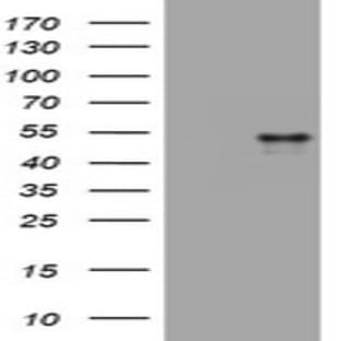 anti-CD4 Molecule (CD4) antibody avatar