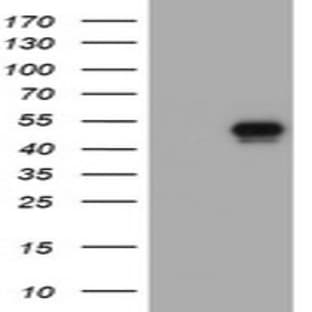 anti-CD4 Molecule (CD4) antibody avatar