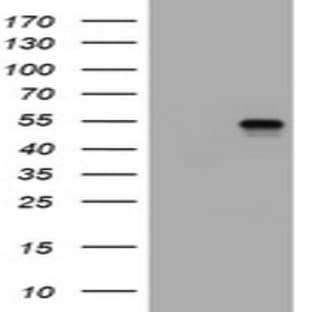 anti-CD4 Molecule (CD4) antibody avatar