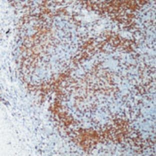 anti-CD4 Molecule (CD4) antibody avatar