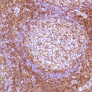anti-CD4 Molecule (CD4) (Internal Region) antibody avatar