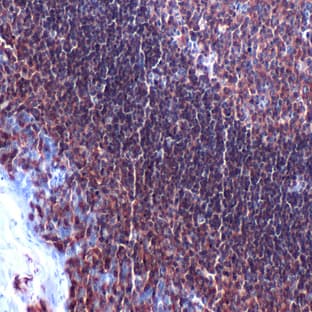 anti-CD4 Molecule (CD4) (Internal Region) antibody avatar