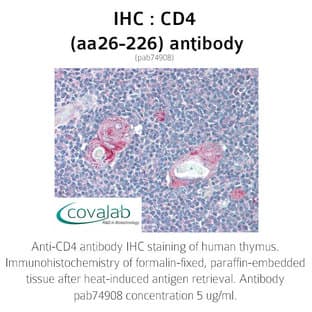 anti-CD4 Molecule (CD4) (AA 26-226) antibody avatar