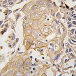 anti-CD4 Molecule (CD4) (N-Term) antibody avatar