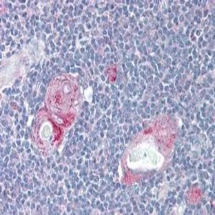 anti-CD4 Molecule (CD4) (AA 26-226) antibody avatar